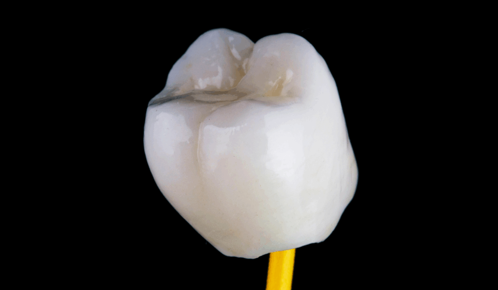 CEREC_Edmonton_dentist
